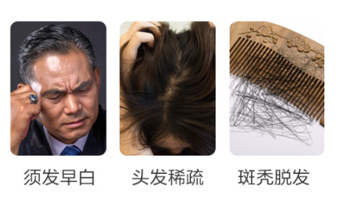 脱发严重 三个原因告诉你为啥脱发