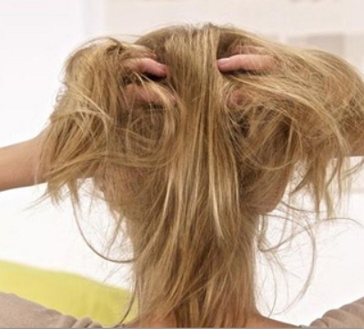 脱发严重的原因是什么 如何来拯救脱发