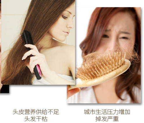 脱发是怎么引起的 7个原因引起脱发