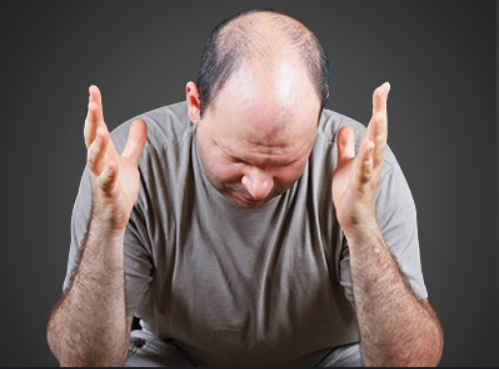 为什么总是掉头发 六个因素影响脱发