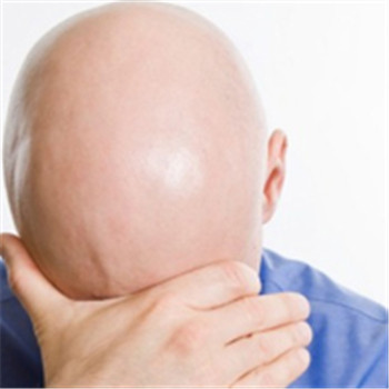 脱发什么原因 揭秘造成脱发的五个原因