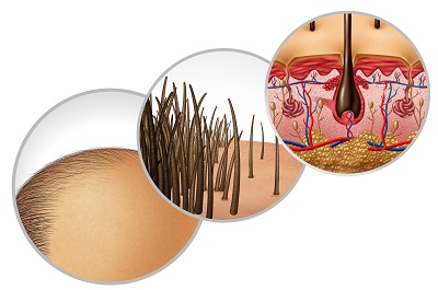 一周头发长10厘米秘诀 介绍三个有效生发偏方