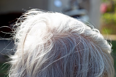 白发能调理成黑发吗？白头发变黑发最有效的方法