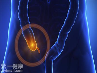 慢性阑尾炎的症状有哪些 解析三大症状表现