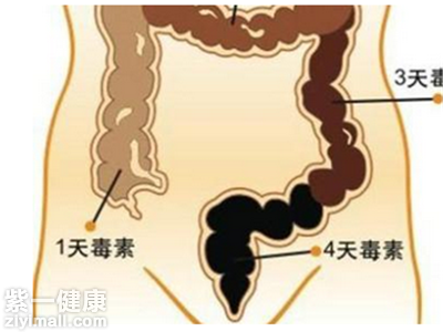 如何给肠道“治堵” 教你五妙招清理肠道