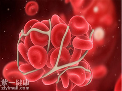 溶血怎么治疗 溶血的五大最佳疗法